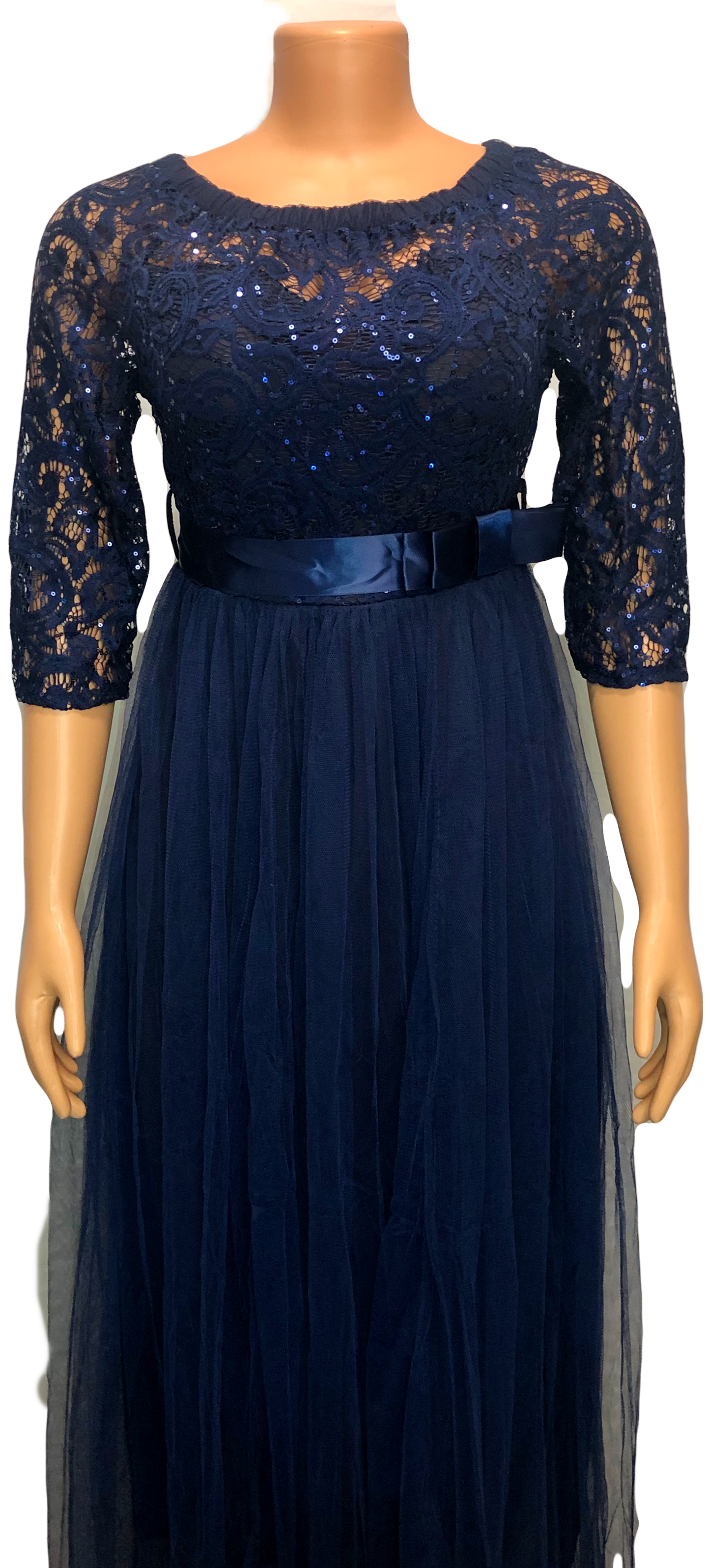 Gold and Blue - Lace Dress